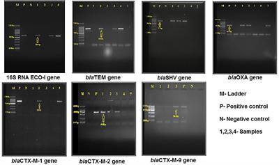 Whole genome sequencing and characteristics of extended-spectrum beta-lactamase producing Escherichia coli isolated from poultry farms in Banaskantha, India